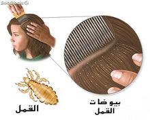 Charger l&#39;image dans la galerie, المشط الكهربائي لإزالة القمل - V-Comb